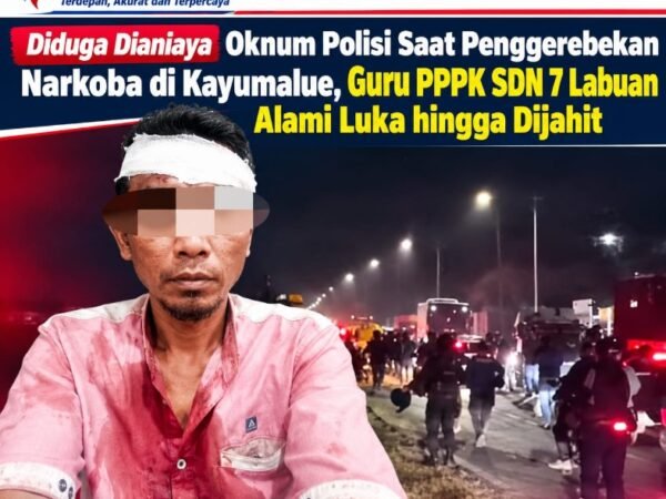 Diduga Dianiaya Oknum Polisi Saat Penggerebekan Narkoba di Kayumalue, Guru PPPK SDN 7 Labuan Alami Luka hingga Dijahit